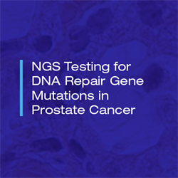 NGS Testing for DNA Repair Gene Mutations in Prostate Cancer